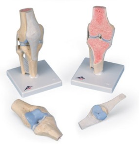무릎관절단면 모형(A89)